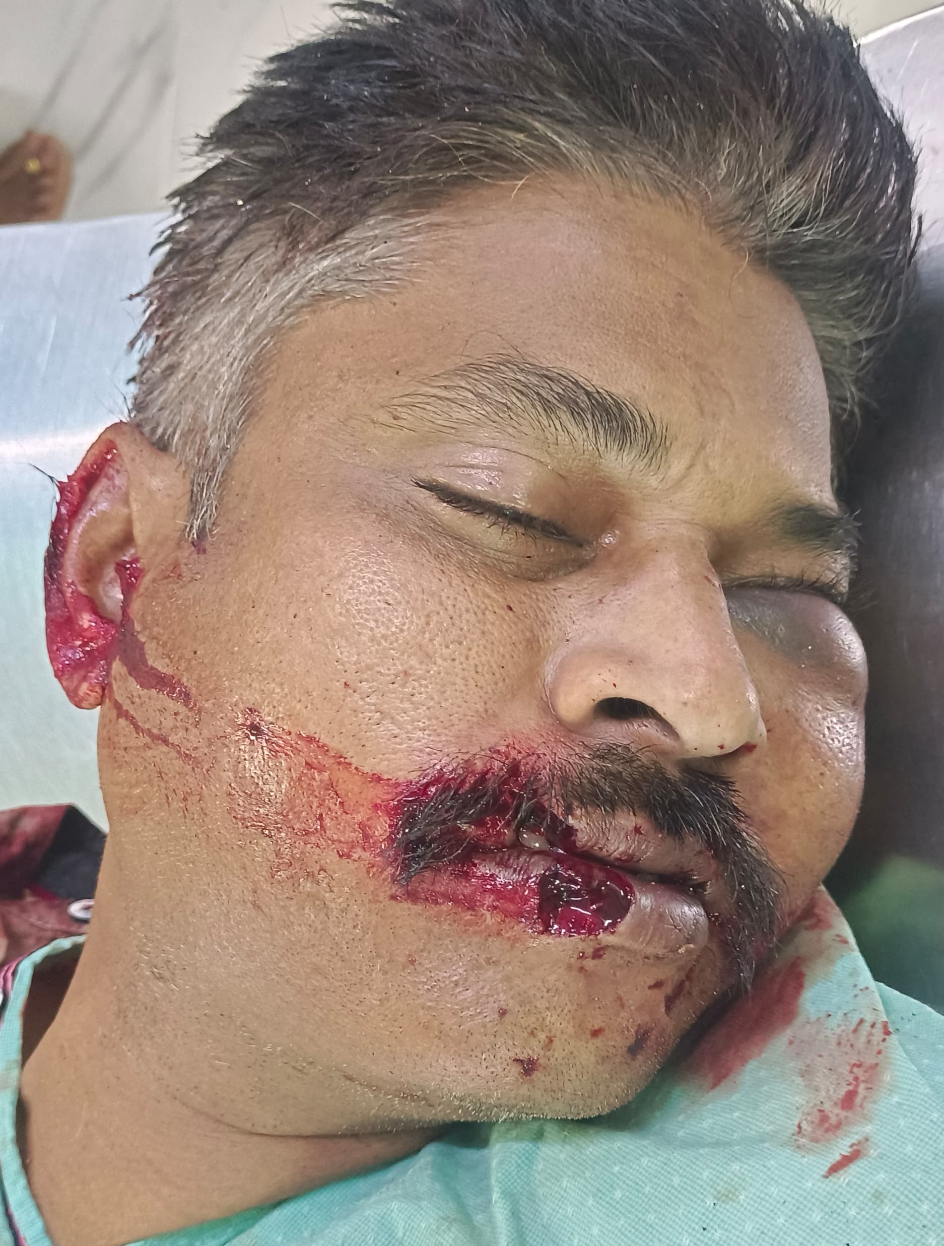 కాకినాడలో దారుణం.. APSP కానిస్టేబుల్‌ను గొంతు కోసి హత్య